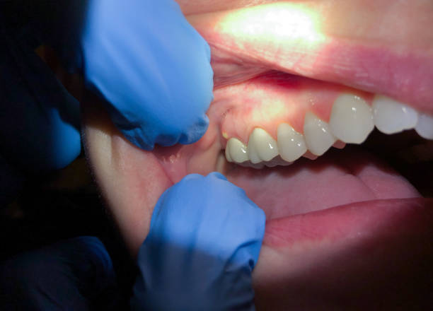 Best Emergency Dental Services for Seniors in Paris, IL