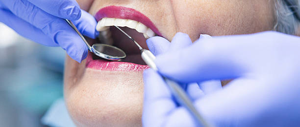 Best Emergency Dentist for Knocked-Out Tooth in Paris, IL